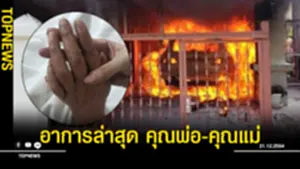 อาการ คุณพ่อ-คุณแม่