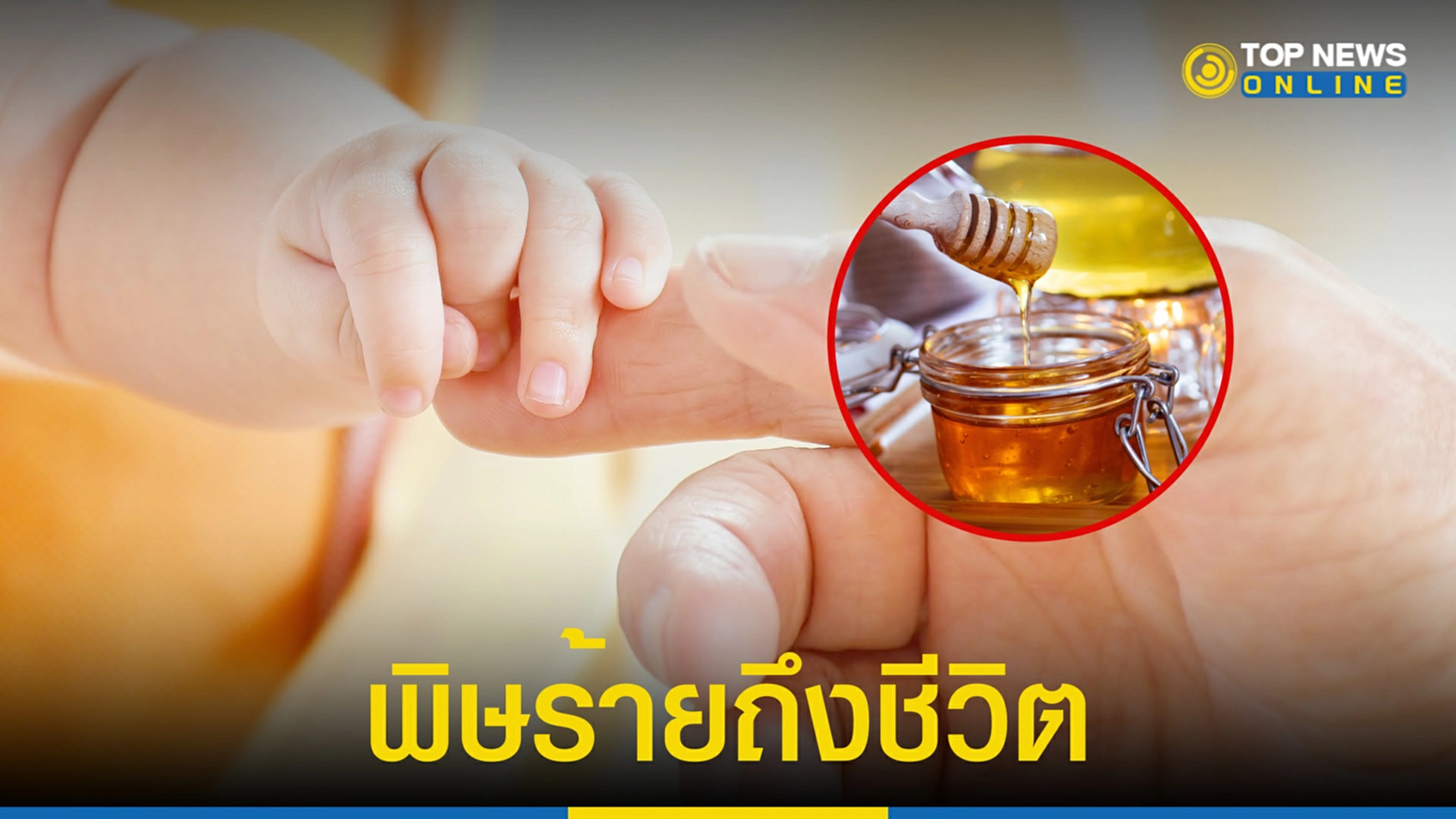น้ำผึ้ง,เด็กทารก, โรคโบทูลิซึม