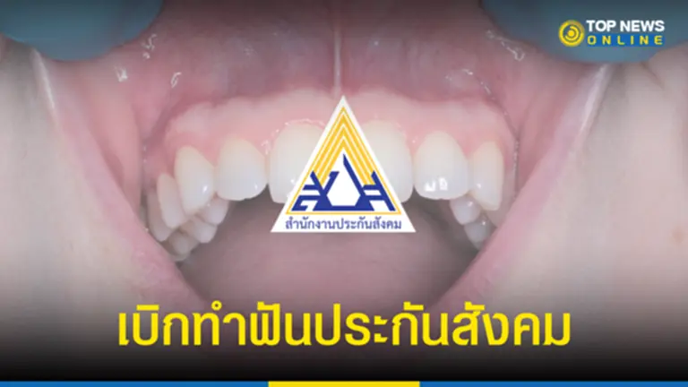 ประกันสังคม ทำฟัน 2565, ประกันสังคม, ทำฟัน, เบิก