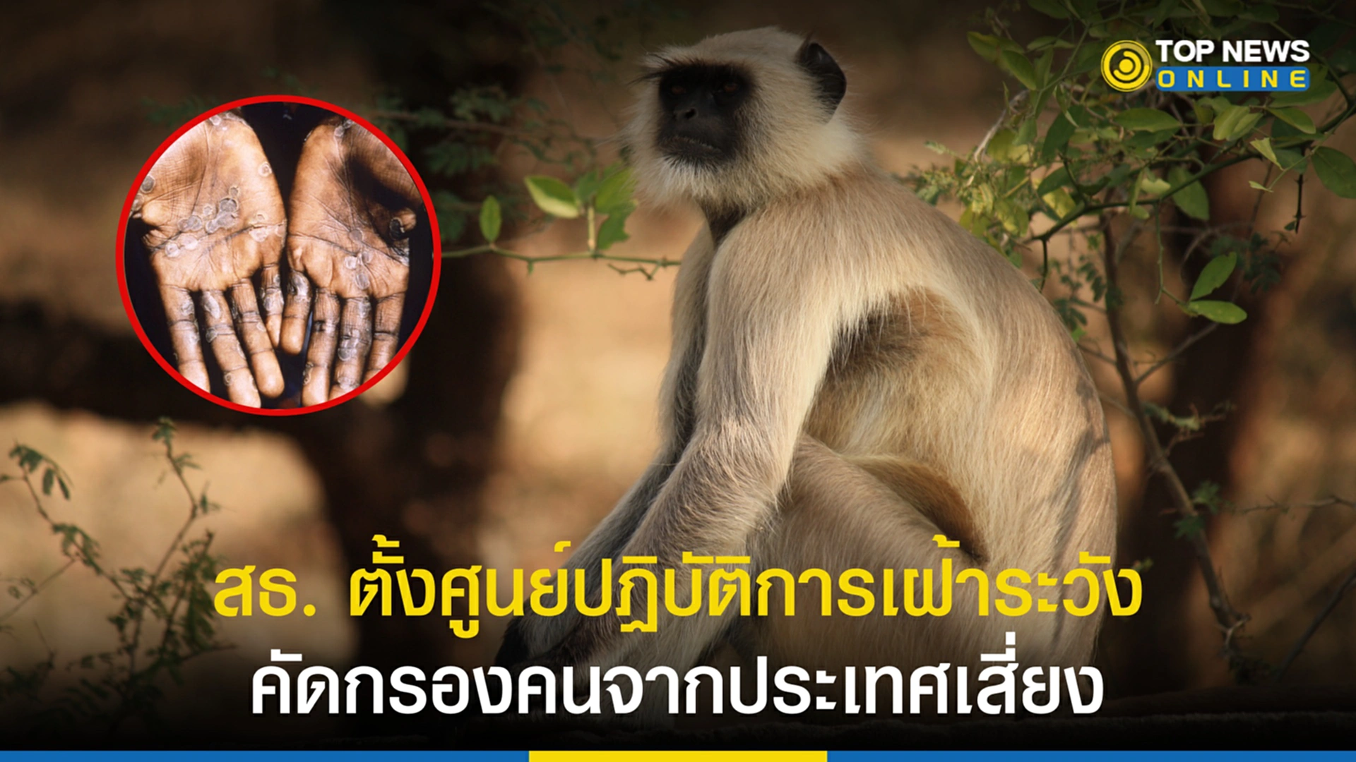 ฝีดาษลิง, โรคฝีดาษลิง, กระทรวงสาธารณสุข, โควิด, Remove term: ศูนย์ปฏิบัติการภาวะฉุกเฉินทางสาธารณสุข ศูนย์ปฏิบัติการภาวะฉุกเฉินทาง, monkeypox