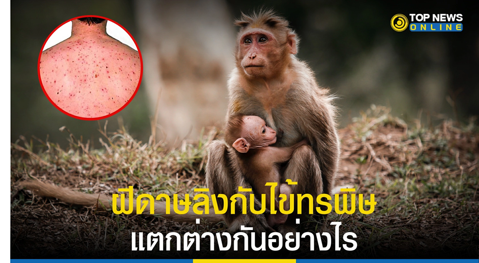 ฝีดาษลิง,โรคฝีดาษลิง, โรคไข้ทรพิษ, ไข้ทรพิษ, ฝีดาษ, ความแตกต่างของฝีดาษลิงและฝีดาษ