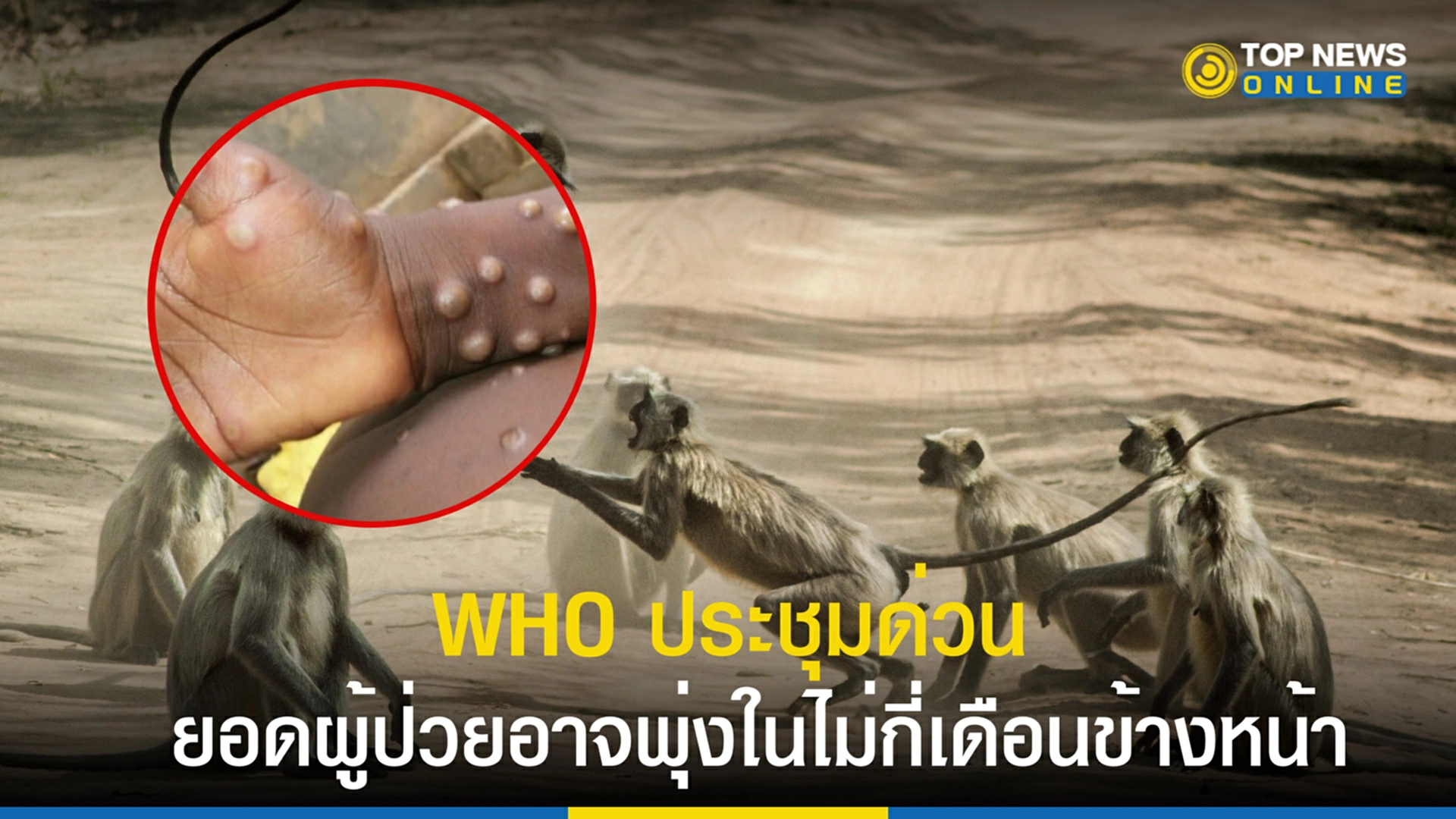 ฝีดาษลิง, โรคฝีดาษ, WHO, องค์การอนามัยโลก, ไข้ทรพิษ, ปลูกฝี