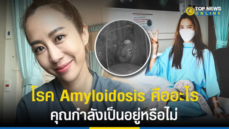 โรค Amyloidosis อะไมลอยด์โดสิส วีเจจ๋า ณัฐฐาวีรนุช