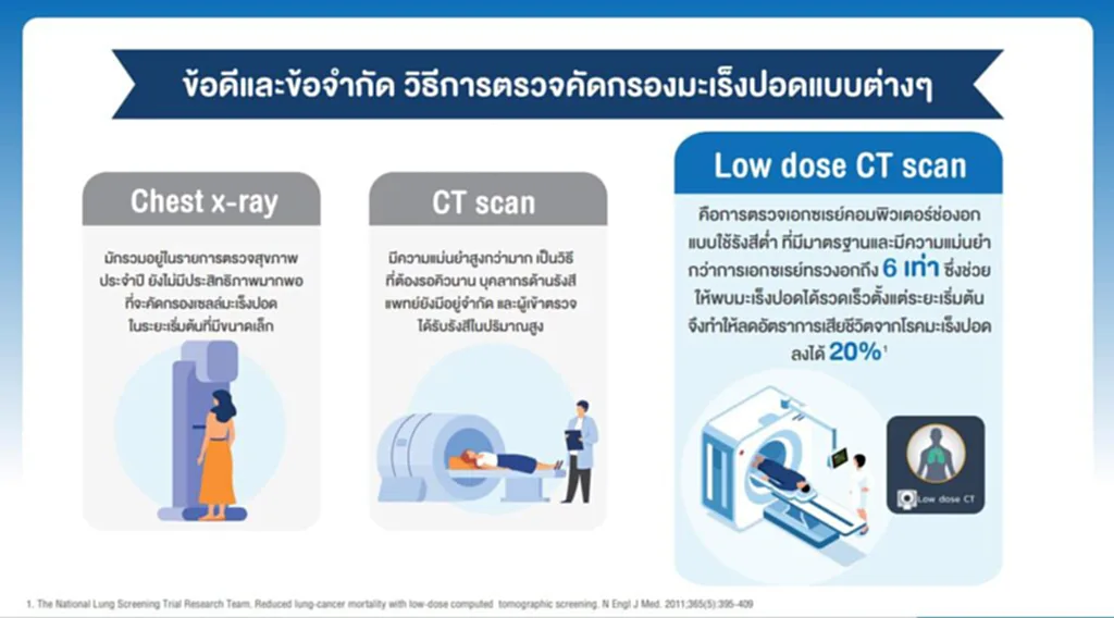 มะเร็งปอด, Chest x-ray, CT scan, Low dose CT scan, หมอมนูญ, ตรวจคัดกรอง, เสียชีวิต