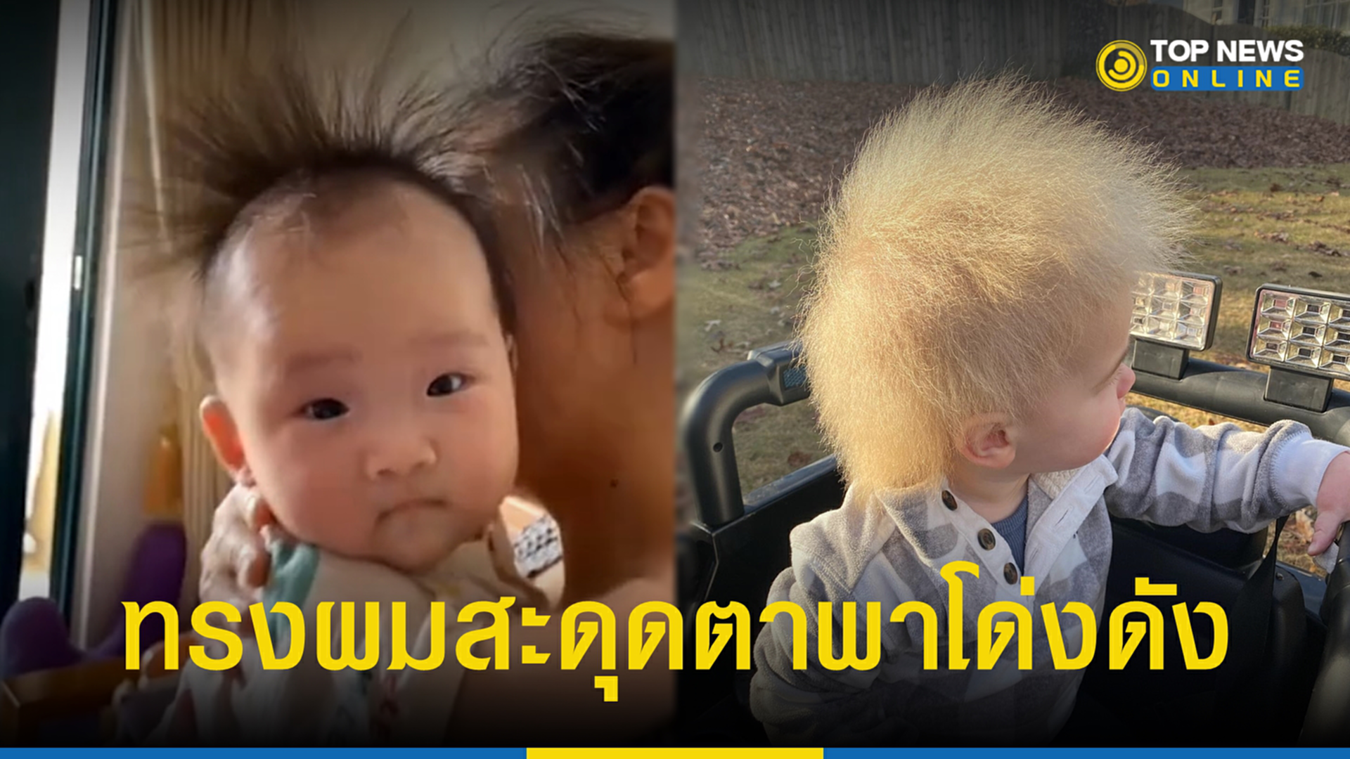 ไอน์สไตน์น้อย, Layla Davis, อัลเบิร์ต ไอน์สไตน์, บอริส จอห์นสัน, uncombable hair syndrome, UHS, ไวรัล, ทรงผม