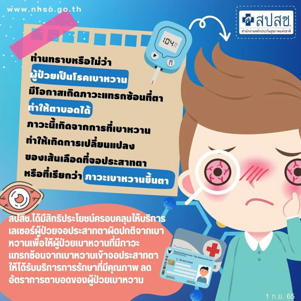 สิทธิบัตรทอง, สิทธิบัตร ทอง 2565, สิทธิ 30 บาท, เบาหวานขึ้นตา, โรคเบาหวาน, เบาหวาน ขึ้น ตา, อาการ เบาหวาน ขึ้น ตา, ภาวะเบาหวานขึ้นตา, สปสช., จักษุแพทย์