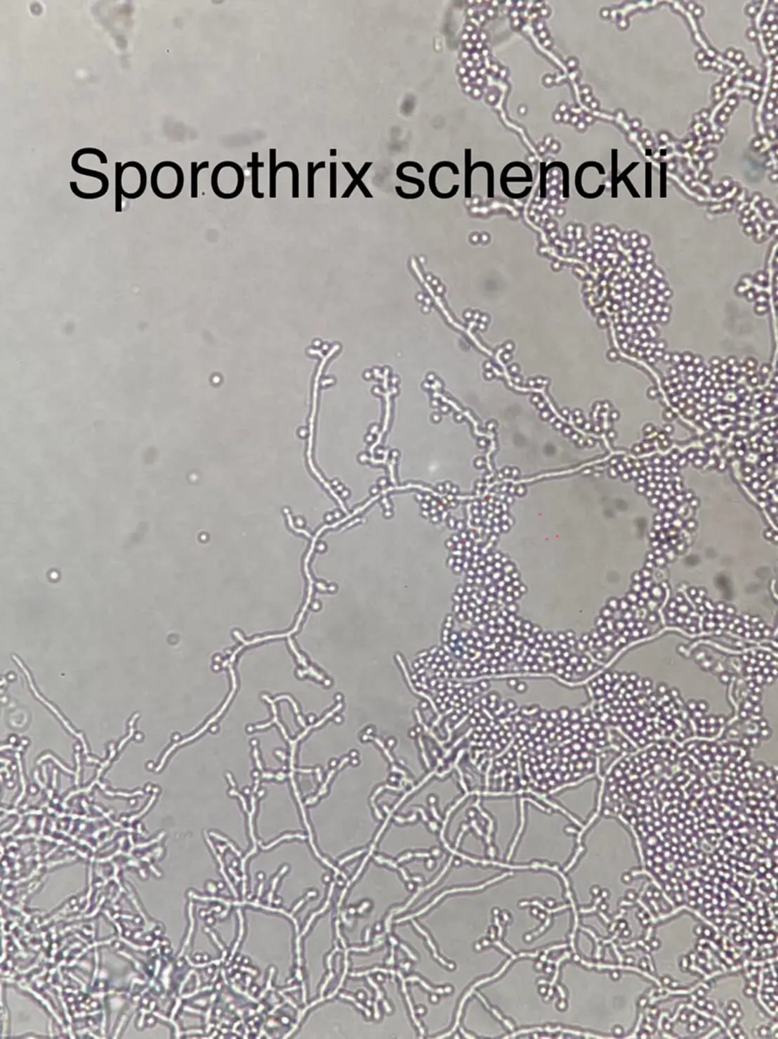 โรคสปอโรทริโคสิส, สปอโรทริโคสิส, Sporotrichosis, Sporothrix schenckii, Itraconazole, หนามกุหลาบ, แมว, ข่วน, กัด, ทาสแมว, หมอมนูญ