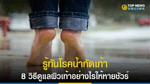 น้ำกัดเท้า, โรคน้ำกัดเท้า, วิธีดูแลเท้า, โรค น้ำ กัด เท้า เกิด จาก, น้ํา กัด เท้า วิธี รักษา, อาการ น้ำ กัด เท้า