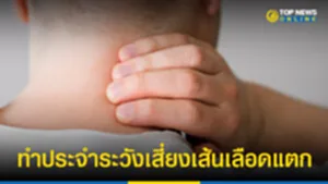 เส้นเลือดแตก