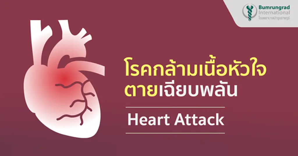 ภาวะหัวใจวาย, congestive heart failure, ข่าว หัวใจ วาย, อาการ หัวใจ วาย, หัวใจ วาย เฉียบพลัน อายุ น้อย, อาการ หัวใจ วาย เฉียบพลัน, หัวใจ ล้ม เหลว เฉียบพลัน, ​ลิ่มเลือดหัวใจอุดตัน, โรคกล้ามเนื้อหัวใจตายเฉียบพลัน, หัวใจวาย, หัวใจขาดเลือด