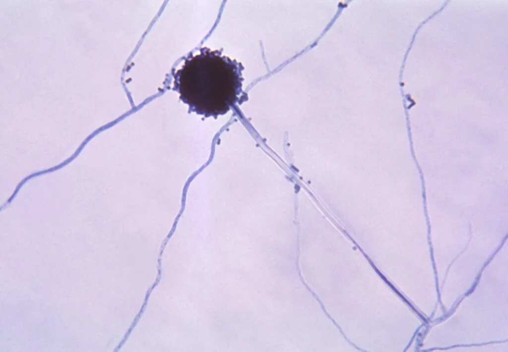 มะเร็ง, สารก่อมะเร็ง, กระเทียม, จุดสีน้ำตาลบนเนื้อกระเทียม, เชื้อรา, Aspergillus, สารพิษ, อะฟลาทอกซิน, จุลินทรีย์, รอยช้ำ