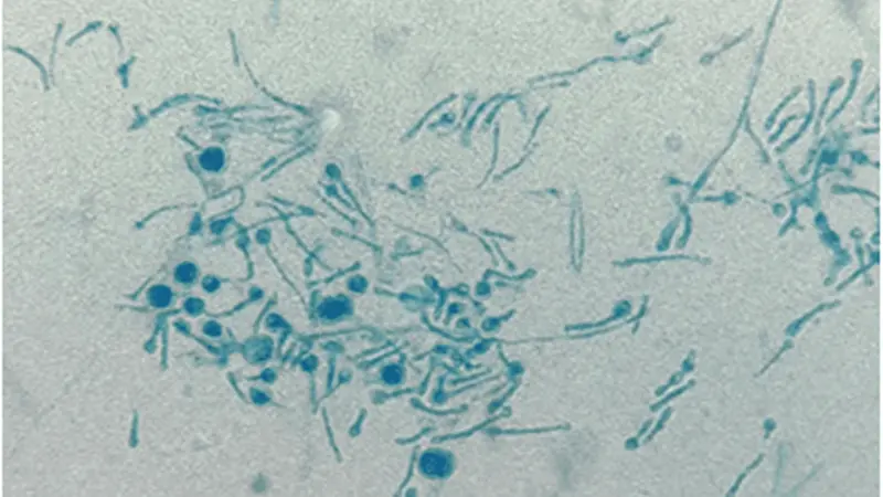 เชื้อรา, โรคใบเงิน, chondrostereum purpureum, เชื้อโรค, ภาวะโลกร้อน, The Last of Us, Ophiocordyceps