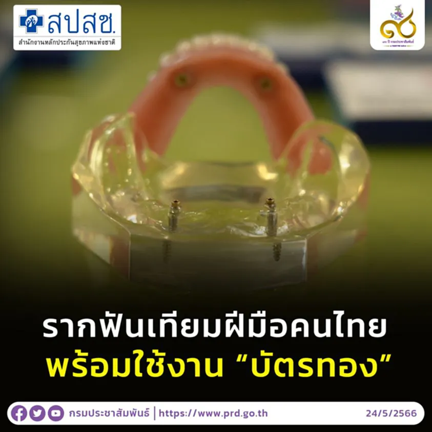 รากฟันเทียมฝีมือคนไทย รากฟันเทียม ฟรี โครงการ รากฟัน เทียมฟรี 2566 รากฟันเทียมบัตรทอง รากฟันเทียม ใช้บัตรทองได้ไหม รากฟันเทียม prk สิทธิบัตรทอง ทําฟัน 2566