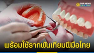 รากฟันเทียมฝีมือคนไทย