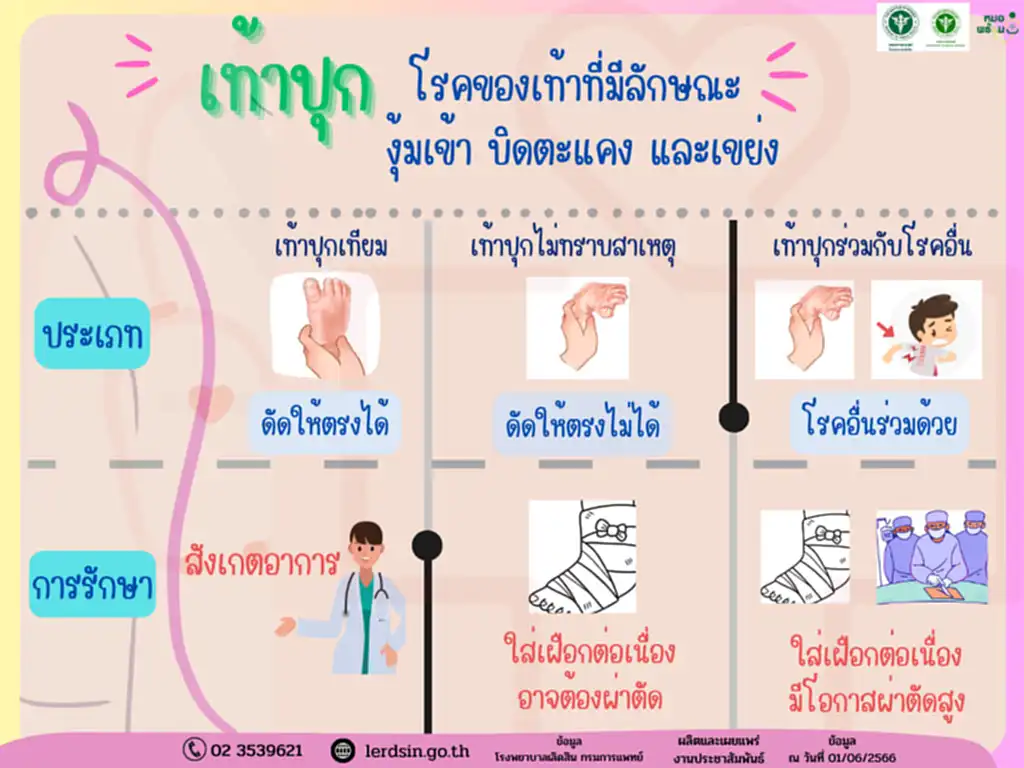 เท้าปุก, โรค เท้า ปุก, เท้างุมเข้า, โรคผิดปกติแต่กำเนิด, เท้าปุกเทียม, เฝือกเท้า