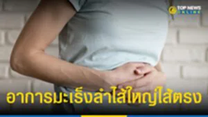 "มะเร็งลำไส้ใหญ่ ไส้ตรง" 1 ใน 5 มะเร็งพบมากในคนไทย เลี่ยงได้