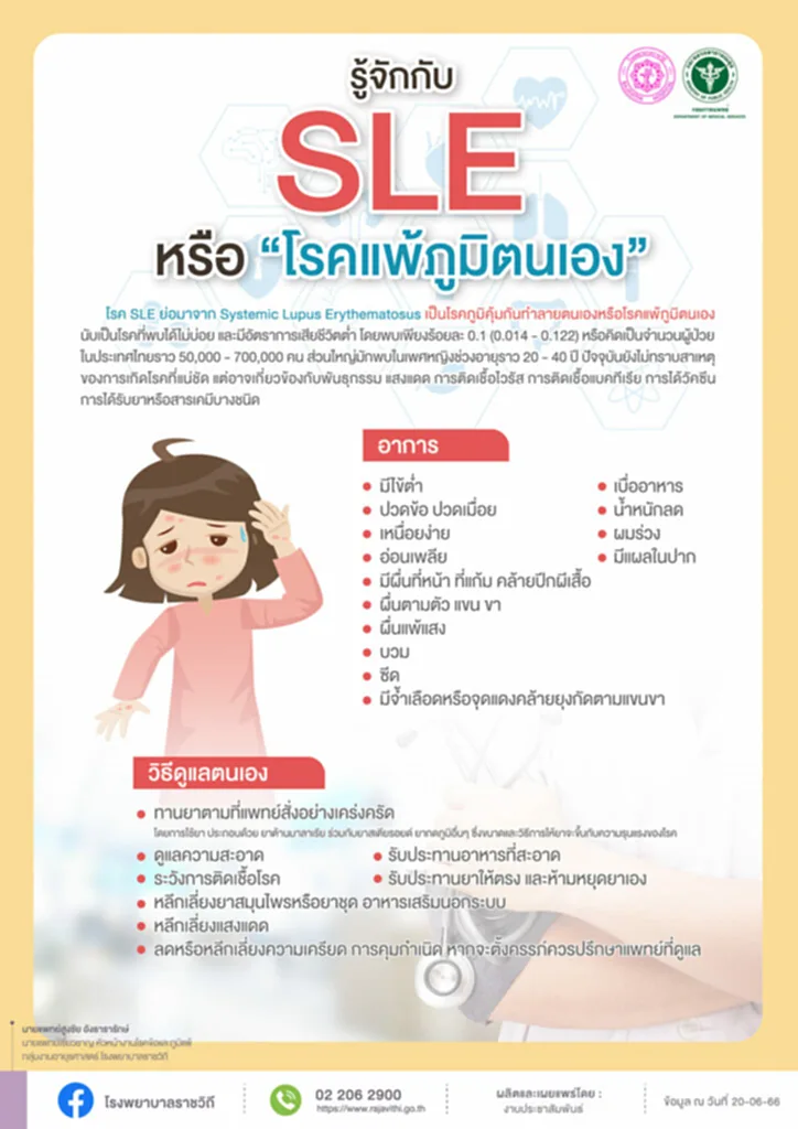 SLE, systemic lupus erythematosus, sle disease, โรค sle อาการ, โรคแพ้ภูมิตัวเอง, โรคพุ่มพวง, การอักเสบของอวัยวะ