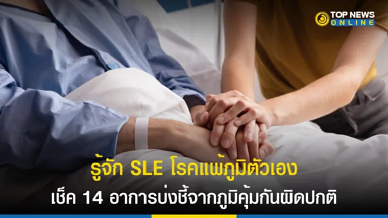 SLE, systemic lupus erythematosus, sle disease, โรค sle อาการ, โรคแพ้ภูมิตัวเอง, โรคพุ่มพวง, การอักเสบของอวัยวะ