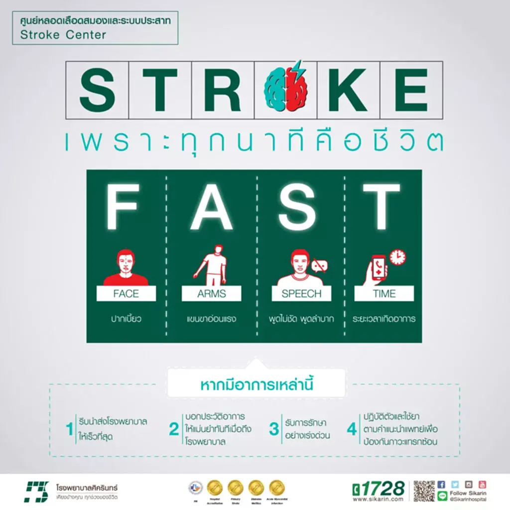 หลอดเลือดสมอง, หลอดเลือด สมอง แตก, โรค หลอดเลือด สมอง อาการ, stroke, โรคหลอดเลือดสมอง, เซลล์สมอง, หลอดเลือดสมองตีบ, เส้นเลือด, สมองขาดเลือดชั่วคราว