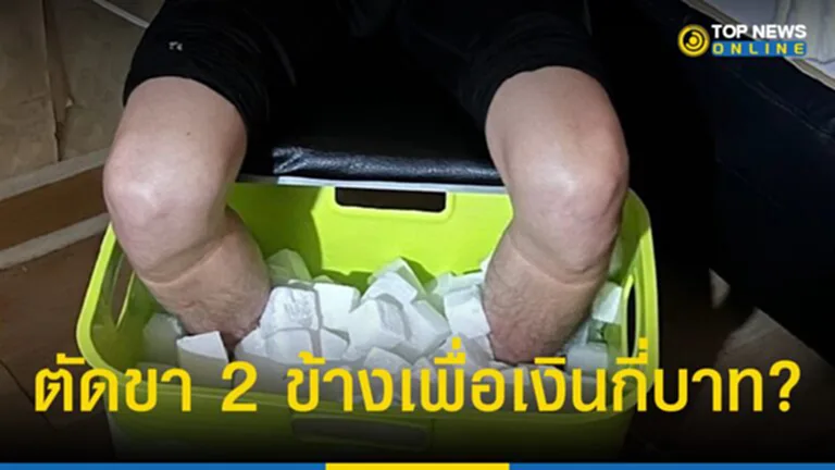 ฉ้อโกงเงินประกัน หนุ่มไต้หวัน ตัดขา 2 ข้าง เพื่อเงินกี่บาท